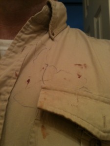 Pen, bloddy shirt-art by bloodied and hysterical 18 month old